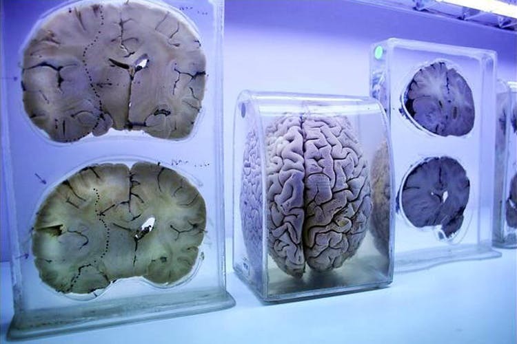 brains